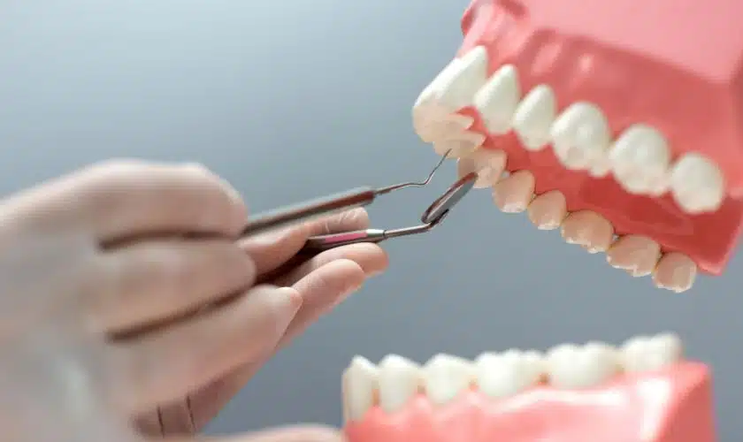Benefits Of Dentures And Bridges: Beyond Aesthetics